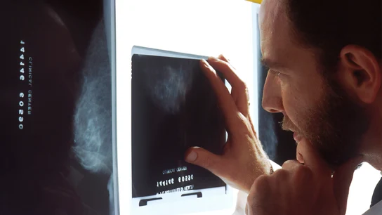 Cáncer de próstata Cáncer de próstata