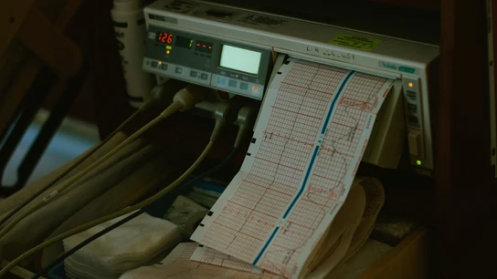 Monitorización del latido del bebé Monitorización del latido del bebé