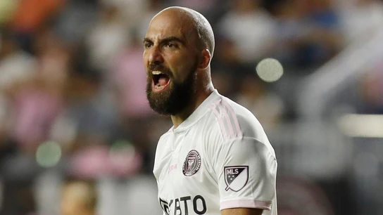 Gonzalo Higuaín Gonzalo Higuaín