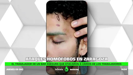 ataque homofobo ataque homofobo