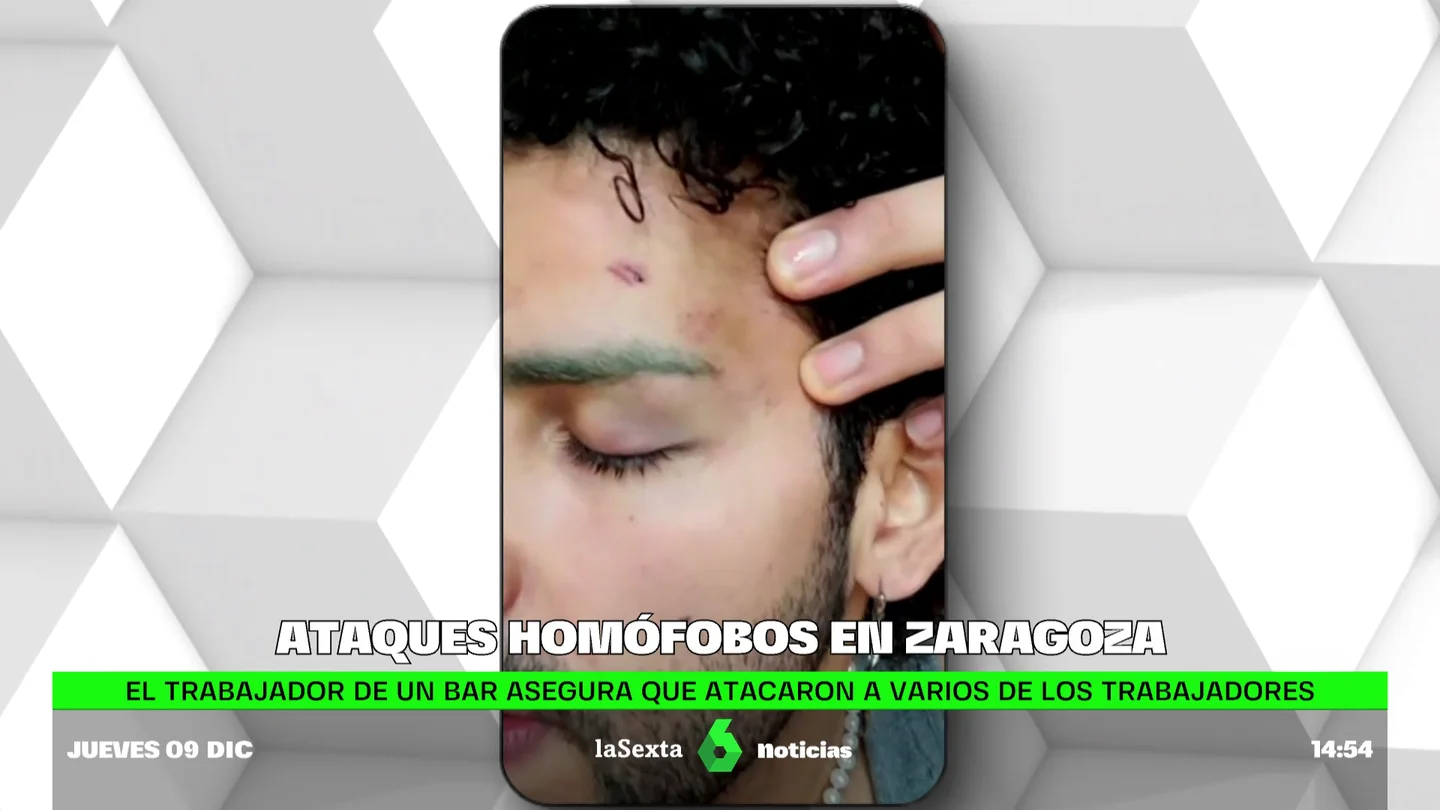 ataque homofobo ataque homofobo
