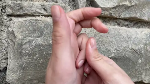 ¿Es realmente malo crujirse los nudillos? ¿Es realmente malo crujirse los nudillos?