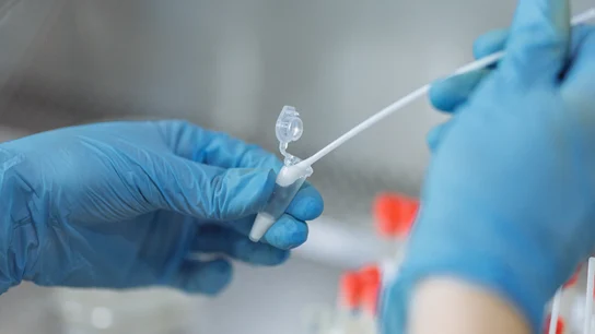 Realización de una PCR Realización de una PCR
