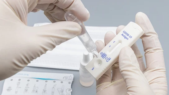 Test de antígenos de autodisgnóstico Test de antígenos de autodisgnóstico