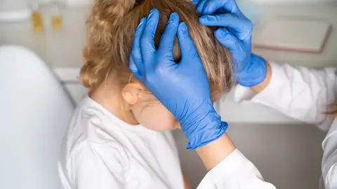 Piojos en niños Piojos en niños