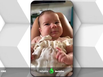 trasplante Greta bebe