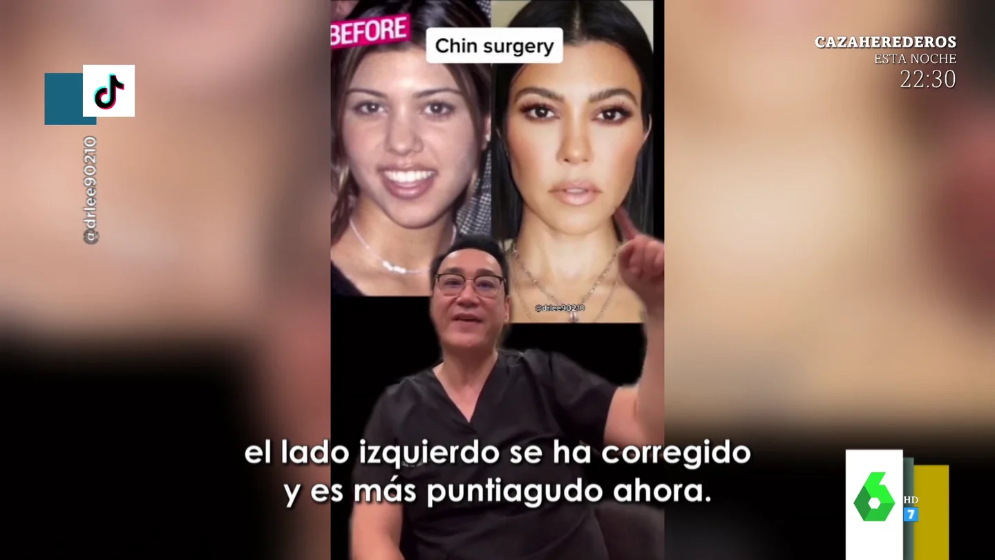 De Taylor Swift a Kourtney Kardashian: el vídeo viral en el que un doctor explica los retoques estéticos de los famosos De Taylor Swift a Kourtney Kardashian: el vídeo viral en el que un doctor explica los retoques estéticos de los famosos