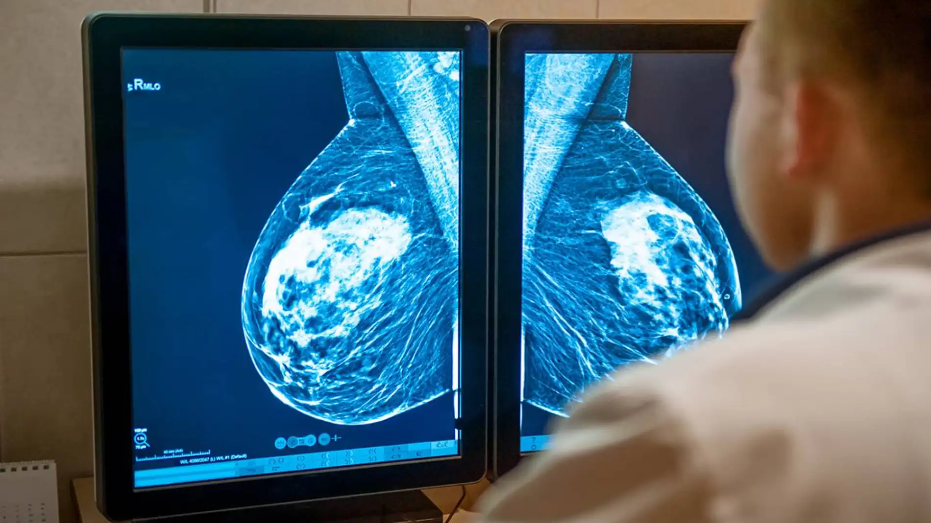 médico revisando una mamografía