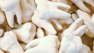 Qué significa soñar que se te caen los dientes