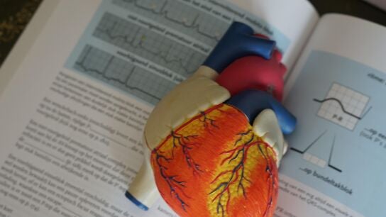 &iquest;Qu&eacute; es un shock hipovol&eacute;mico?