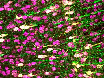 Neuronas activadas (blanco) y no mediante sonidos en el cerebro del ratón Neuronas activadas (blanco) y no mediante sonidos en el cerebro del ratón