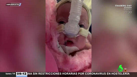 Abuela resucita bebé Abuela resucita bebé