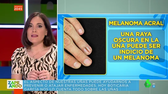 Boticaria García advierte sobre las uñas con una raya oscura: "Si te sale, ve al dermatólogo para un control de cáncer de piel" Boticaria García advierte sobre las uñas con una raya oscura: "Si te sale, ve al dermatólogo para un control de cáncer de piel"