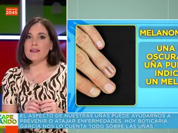 Boticaria García advierte sobre las uñas con una raya oscura: &quot;Si te sale, ve al dermatólogo para un control de cáncer de piel&quot;