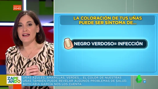 ¿Qué pasa si tienes las uñas azul? ¿y negro verdoso? Boticaria García te explica el significado de cada color ¿Qué pasa si tienes las uñas azul? ¿y negro verdoso? Boticaria García te explica el significado de cada color