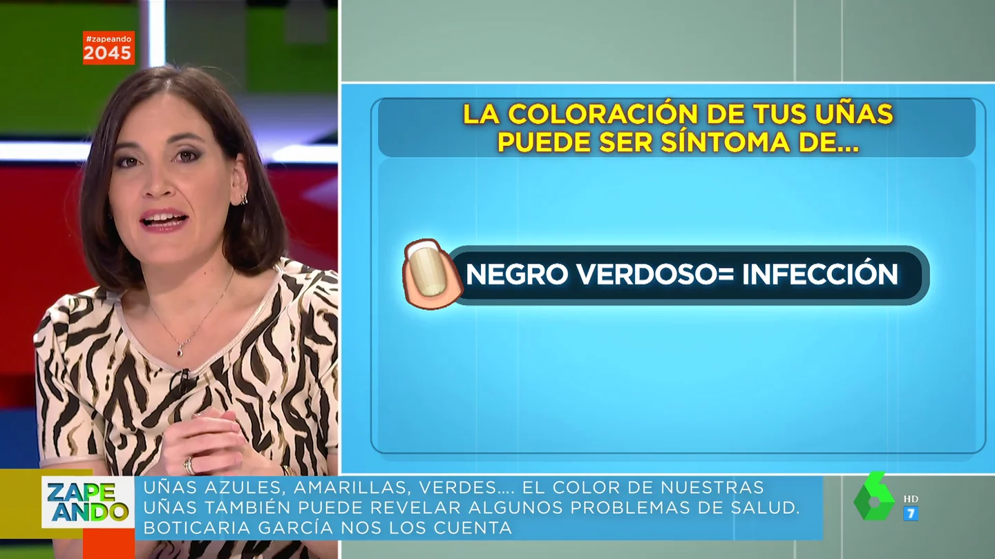 ¿Qué pasa si tienes las uñas azul? ¿y negro verdoso? Boticaria García te explica el significado de cada color ¿Qué pasa si tienes las uñas azul? ¿y negro verdoso? Boticaria García te explica el significado de cada color
