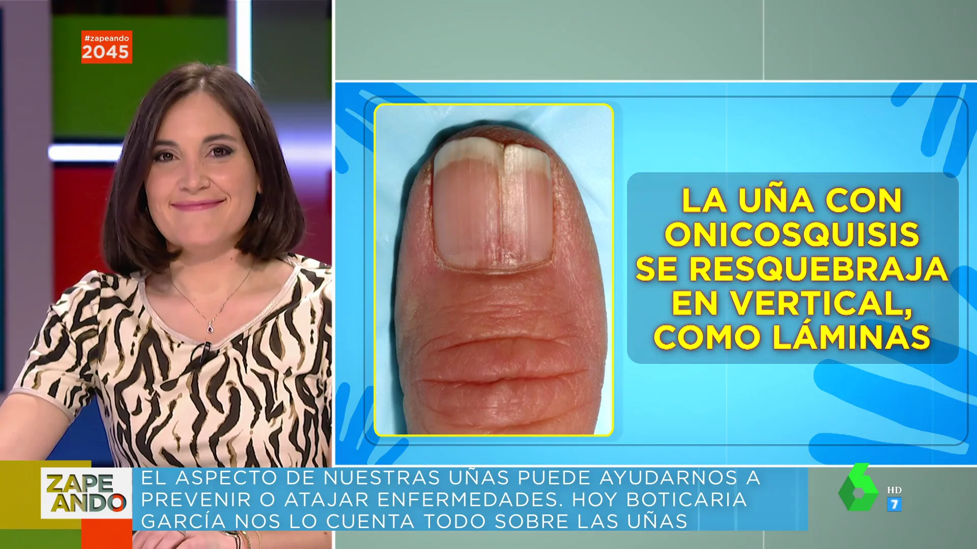 De la uña picada a los uñeros: Boticaria García detalla los problemas de salud que pueden estar detrás