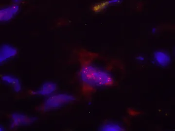 Núcleo de una célula pancreática Núcleo de una célula pancreática