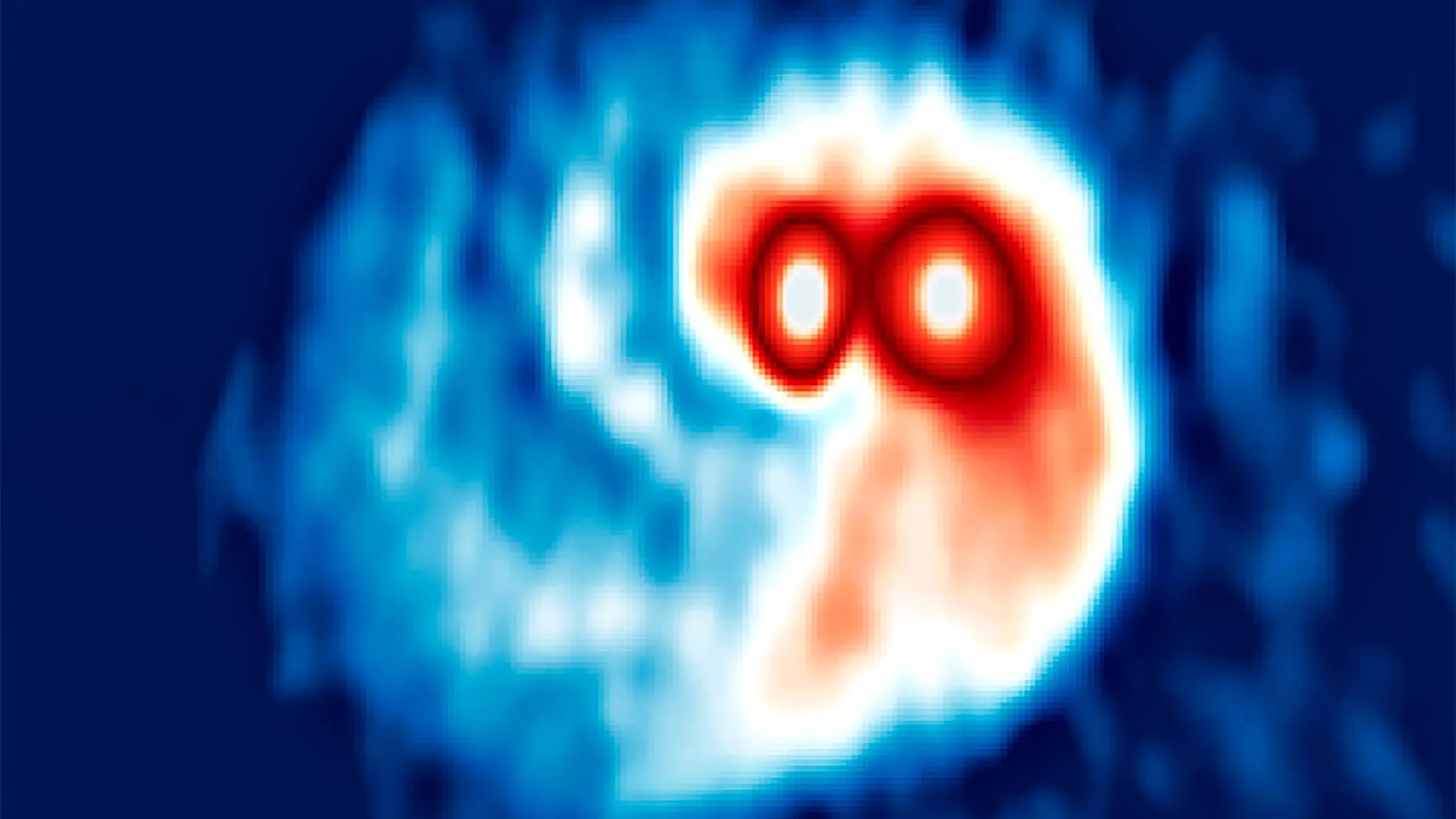 Observaciones realizadas con el radiotelescopio ALMA de los discos de polvo alrededor de la estrella doble SVS13