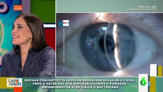 Qué hacer si tienes conjuntivitis: Boticaria García explica cómo se cura Qué hacer si tienes conjuntivitis: Boticaria García explica cómo se cura