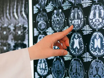 Cerebro Cerebro