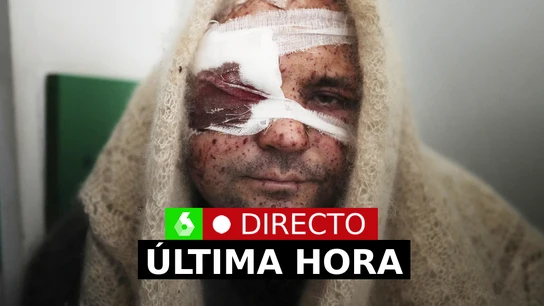 Guerra Ucrania Rusia: Última hora, directo: Ataque de Vladímir Putin a Kiev, Zelenski y la OTAN Guerra Ucrania Rusia: Última hora, directo: Ataque de Vladímir Putin a Kiev, Zelenski y la OTAN