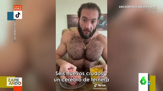 cerebro cerebro
