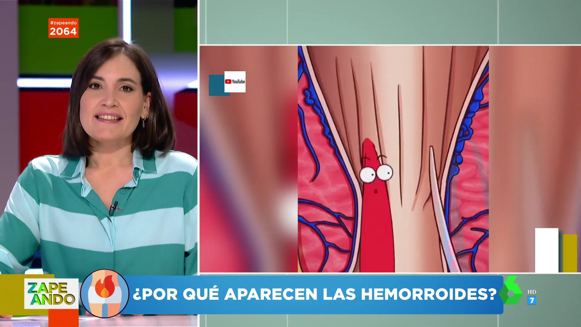 ¿Por qué salen las hemorroides? Boticaria García lo explica en Zapeando