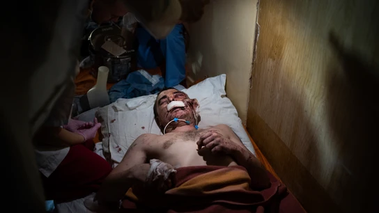 Trabajadores médicos atienden a un hombre herido por bombardeos en un hospital de Mariupol, Ucrania, el viernes 4 de marzo de 2022. Trabajadores médicos atienden a un hombre herido por bombardeos en un hospital de Mariupol, Ucrania, el viernes 4 de marzo de 2022.