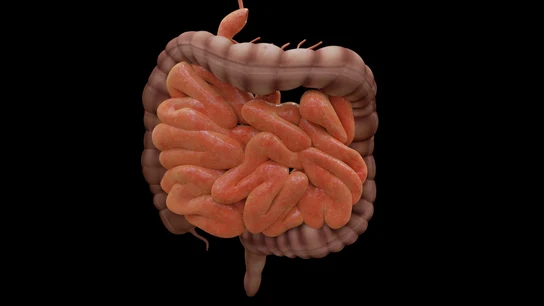 Así son las pruebas de cribado del cáncer de colon: si se detecta precozmente, el 90% de los casos se curan Así son las pruebas de cribado del cáncer de colon: si se detecta precozmente, el 90% de los casos se curan