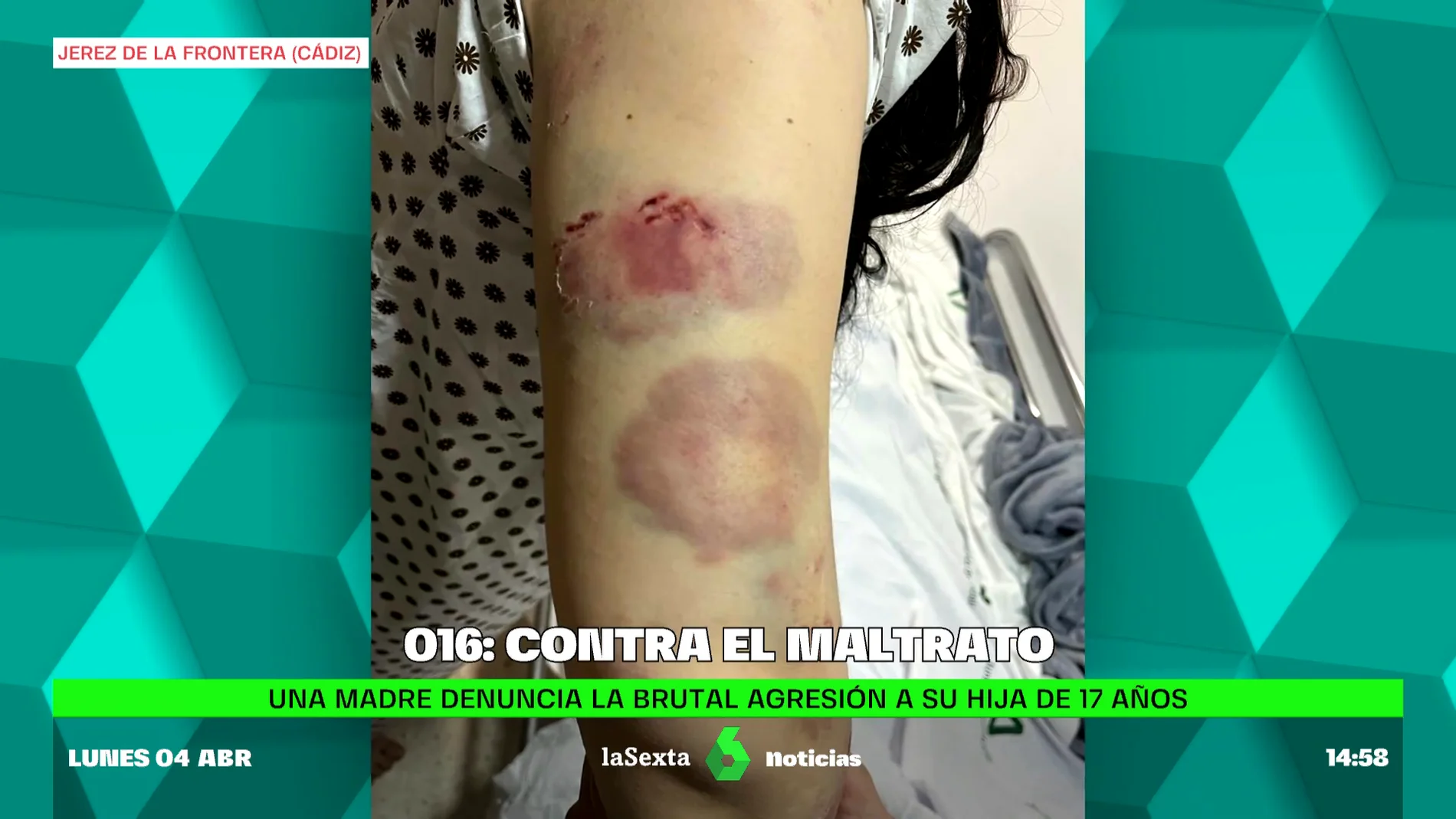 Brutal agresión machista a una menor en Jerez: Brutal agresión machista a una menor en Jerez: