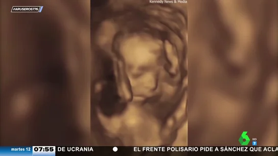 feto peineta feto peineta