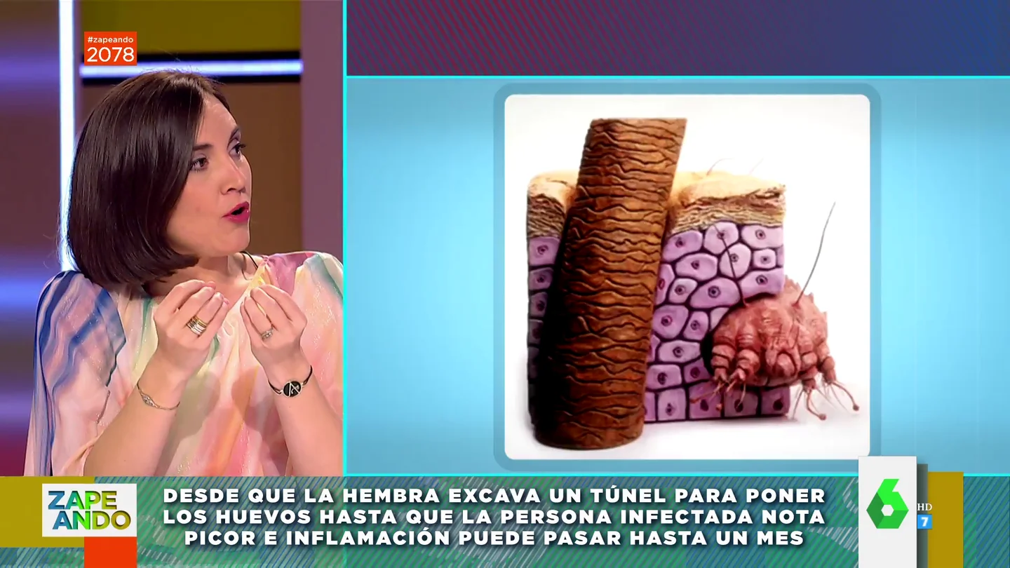 Cómo saber si tienes sarna: Boticaria García explica los síntomas ante el aumento de casos en España Cómo saber si tienes sarna: Boticaria García explica los síntomas ante el aumento de casos en España