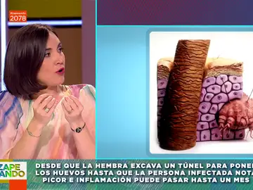 Cómo saber si tienes sarna: Boticaria García explica los síntomas ante el aumento de casos en España