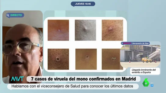 El viceconsejero de Salud Pública de Madrid, Antonio Zapatero El viceconsejero de Salud Pública de Madrid, Antonio Zapatero