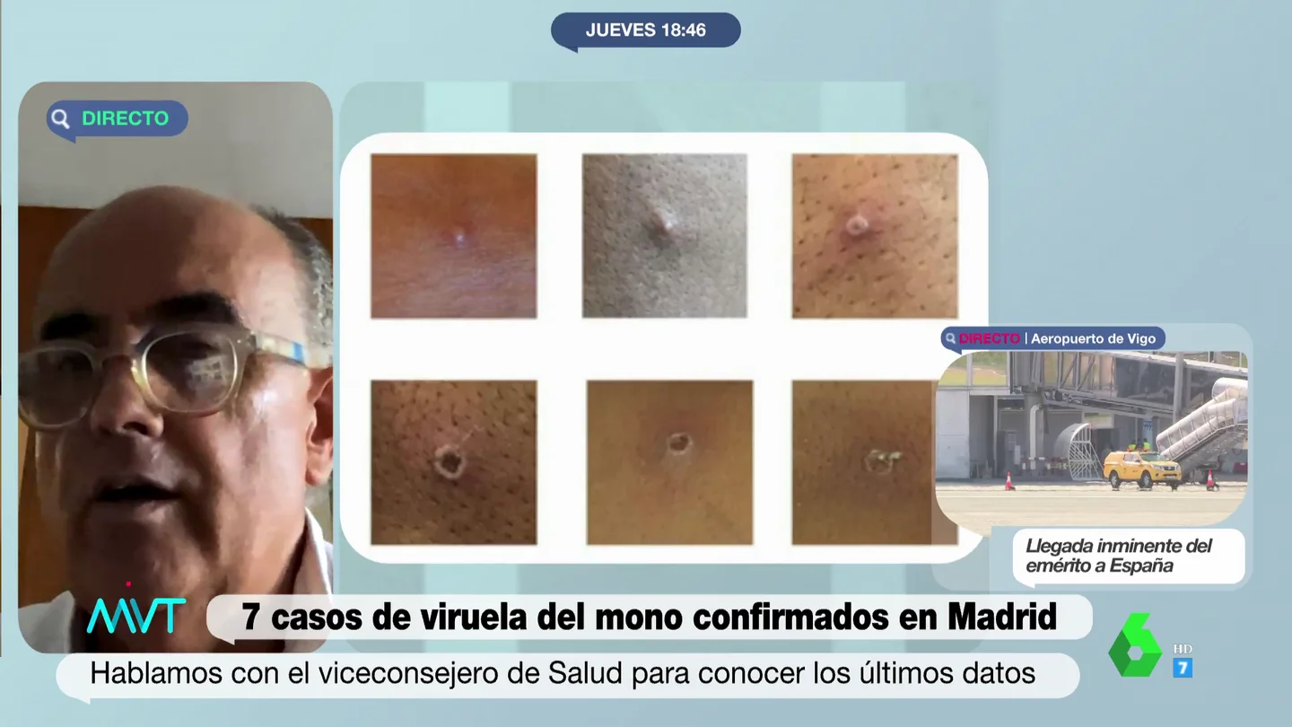 El viceconsejero de Salud Pública de Madrid, Antonio Zapatero El viceconsejero de Salud Pública de Madrid, Antonio Zapatero