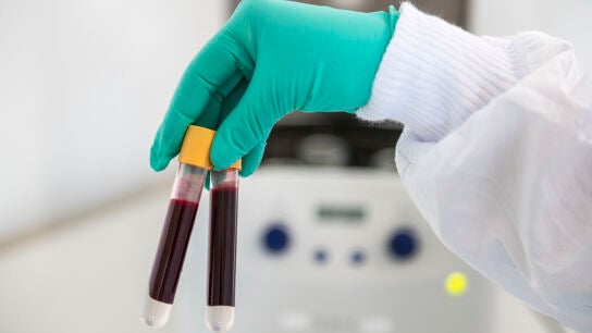 An&aacute;lisis de sangre