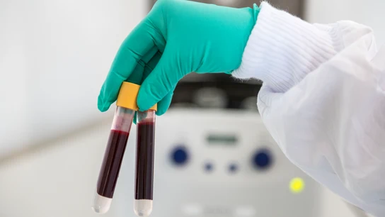 Análisis de sangre Análisis de sangre