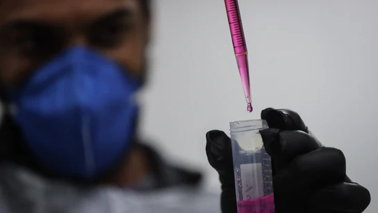 España estudia 30 casos de hepatitis aguda grave, 24 de ellos menores de 10 años España estudia 30 casos de hepatitis aguda grave, 24 de ellos menores de 10 años