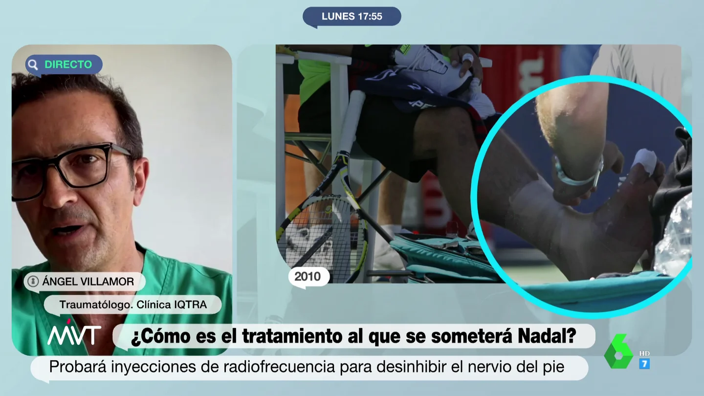 LESION NADAL LESION NADAL
