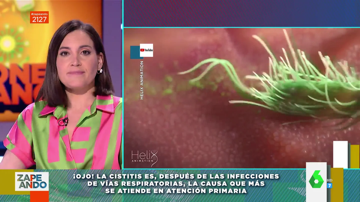 Por qué la cistitis afecta más a las mujeres que a los hombres: Boticaria García explica las causas Por qué la cistitis afecta más a las mujeres que a los hombres: Boticaria García explica las causas