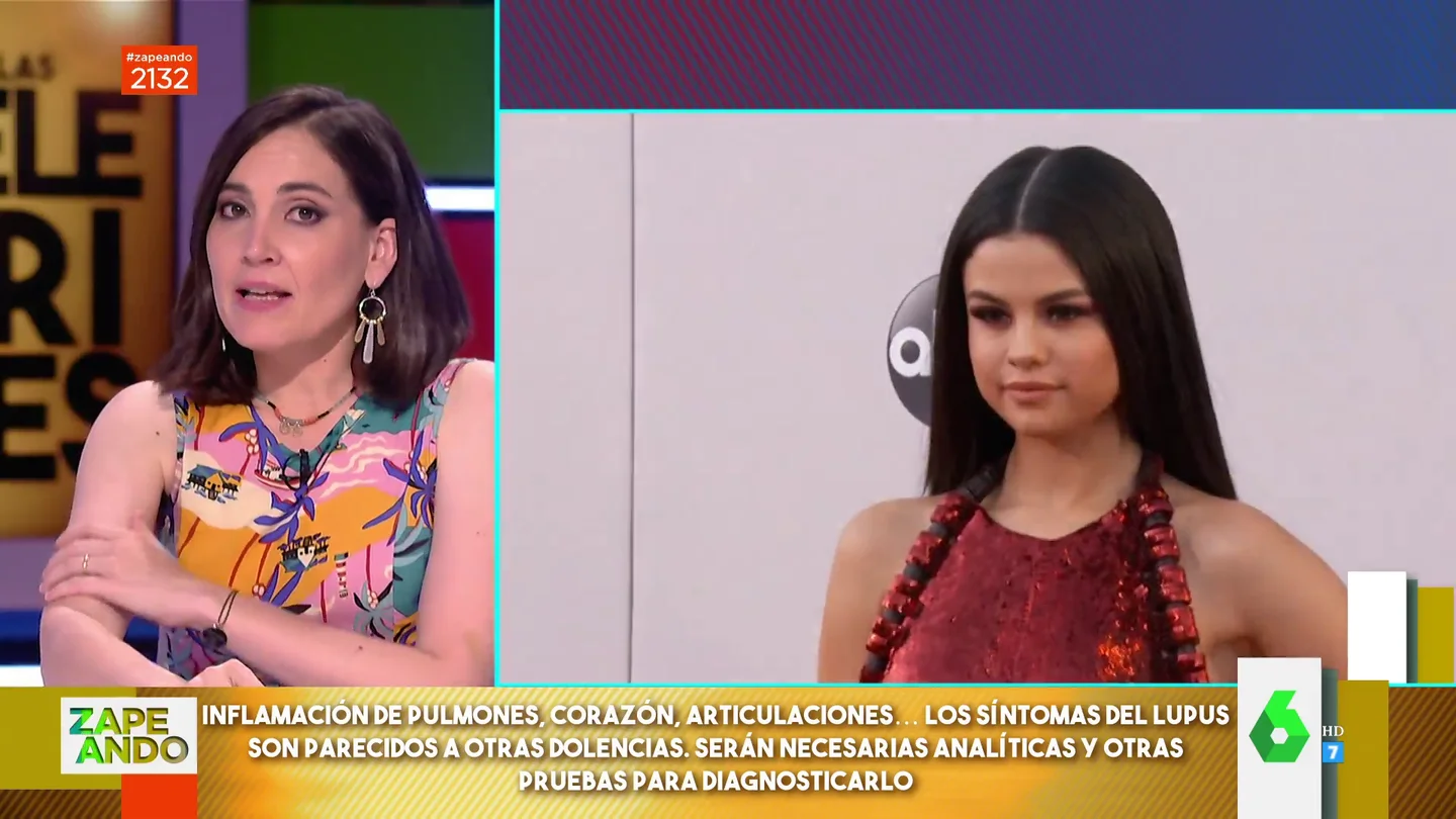 Qué es el lupus, la enfermedad de Lady Gaga y Selena Gómez: Boticaria García explica cómo diferenciarlo de otras enfermedades Qué es el lupus, la enfermedad de Lady Gaga y Selena Gómez: Boticaria García explica cómo diferenciarlo de otras enfermedades