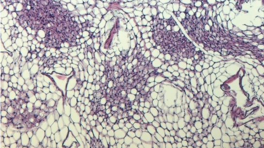 Tejido adiposo blanco con adipocitos blanco y beige. VILLANUEVA LAB - Archivo Tejido adiposo blanco con adipocitos blanco y beige. VILLANUEVA LAB - Archivo