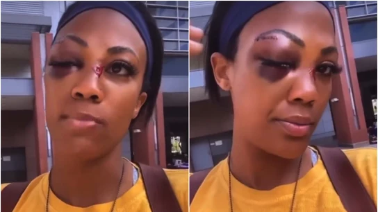 Kim Glass, agredida por un vagabundo Kim Glass, agredida por un vagabundo