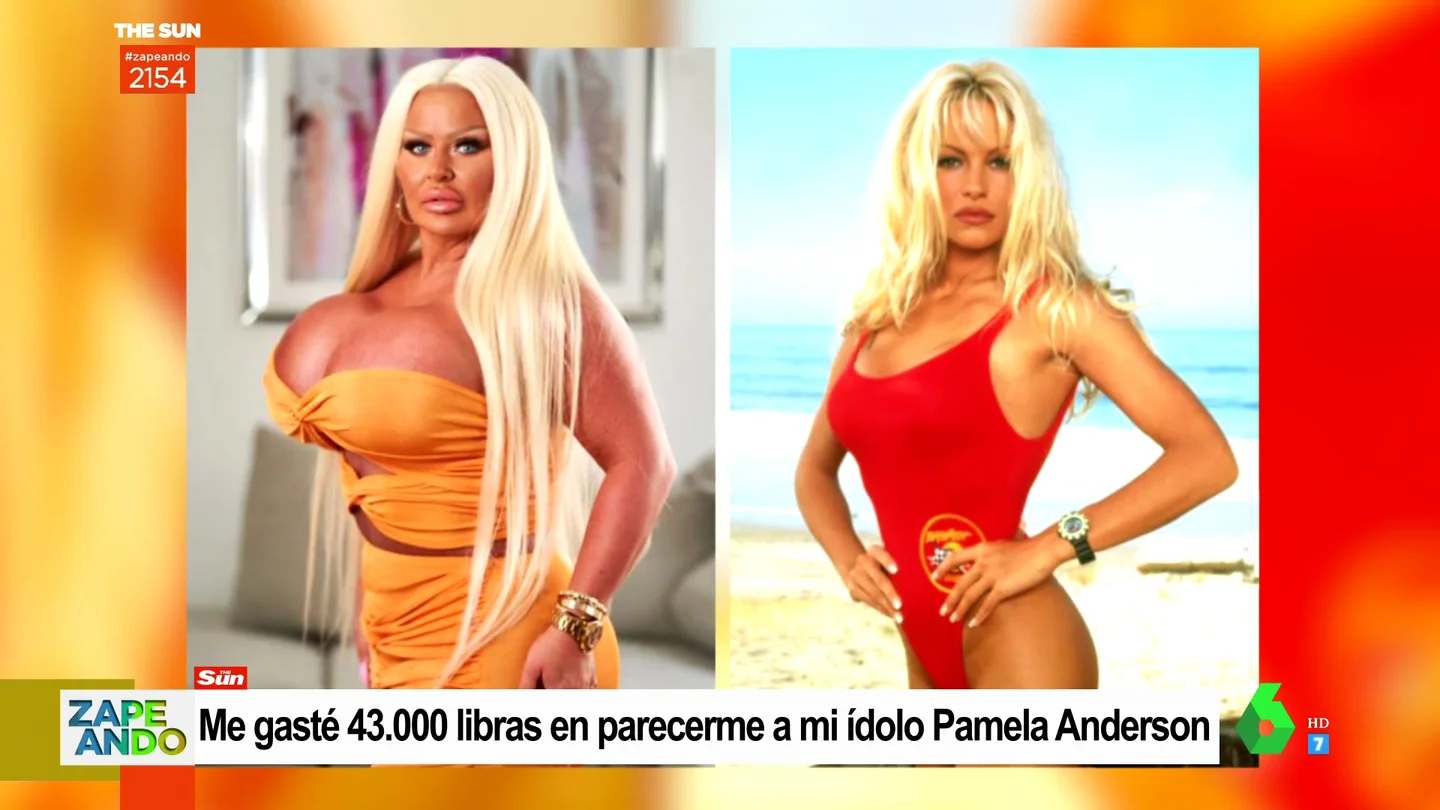 Una mujer se opera para parecerse a Pamela Anderson Una mujer se opera para parecerse a Pamela Anderson