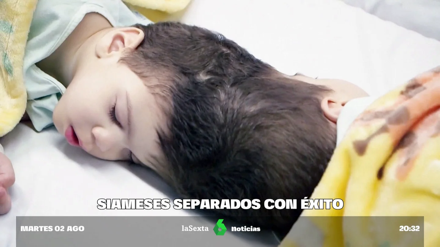 siameses siameses