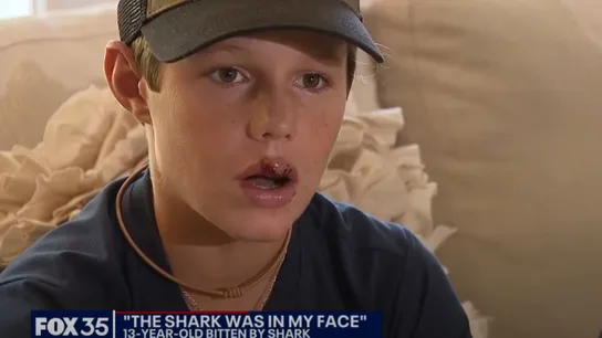 Captura de la entrevista al niño mordido por el tiburón en Florida Captura de la entrevista al niño mordido por el tiburón en Florida