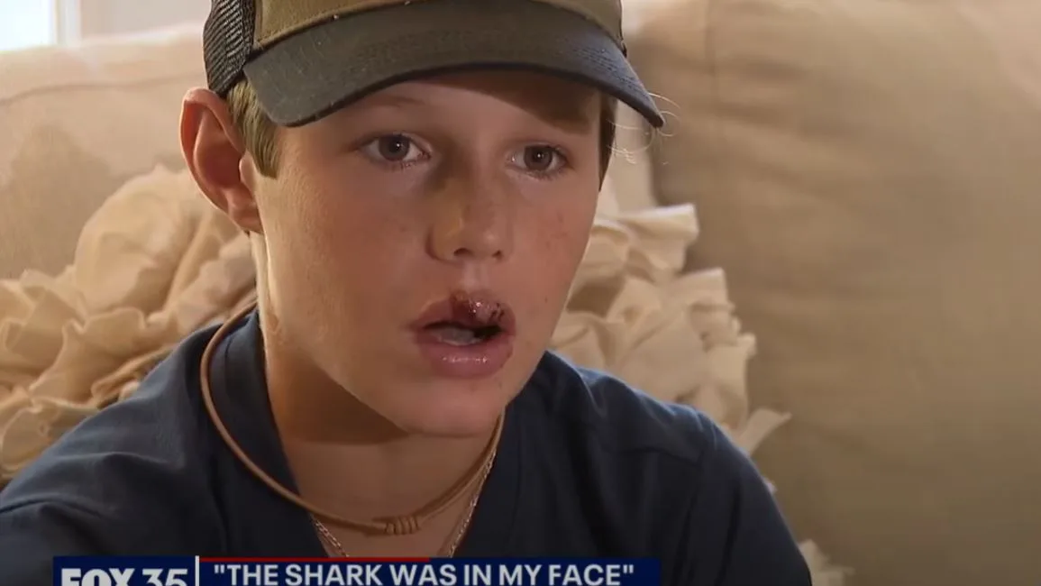 Captura de la entrevista al niño mordido por el tiburón en Florida 