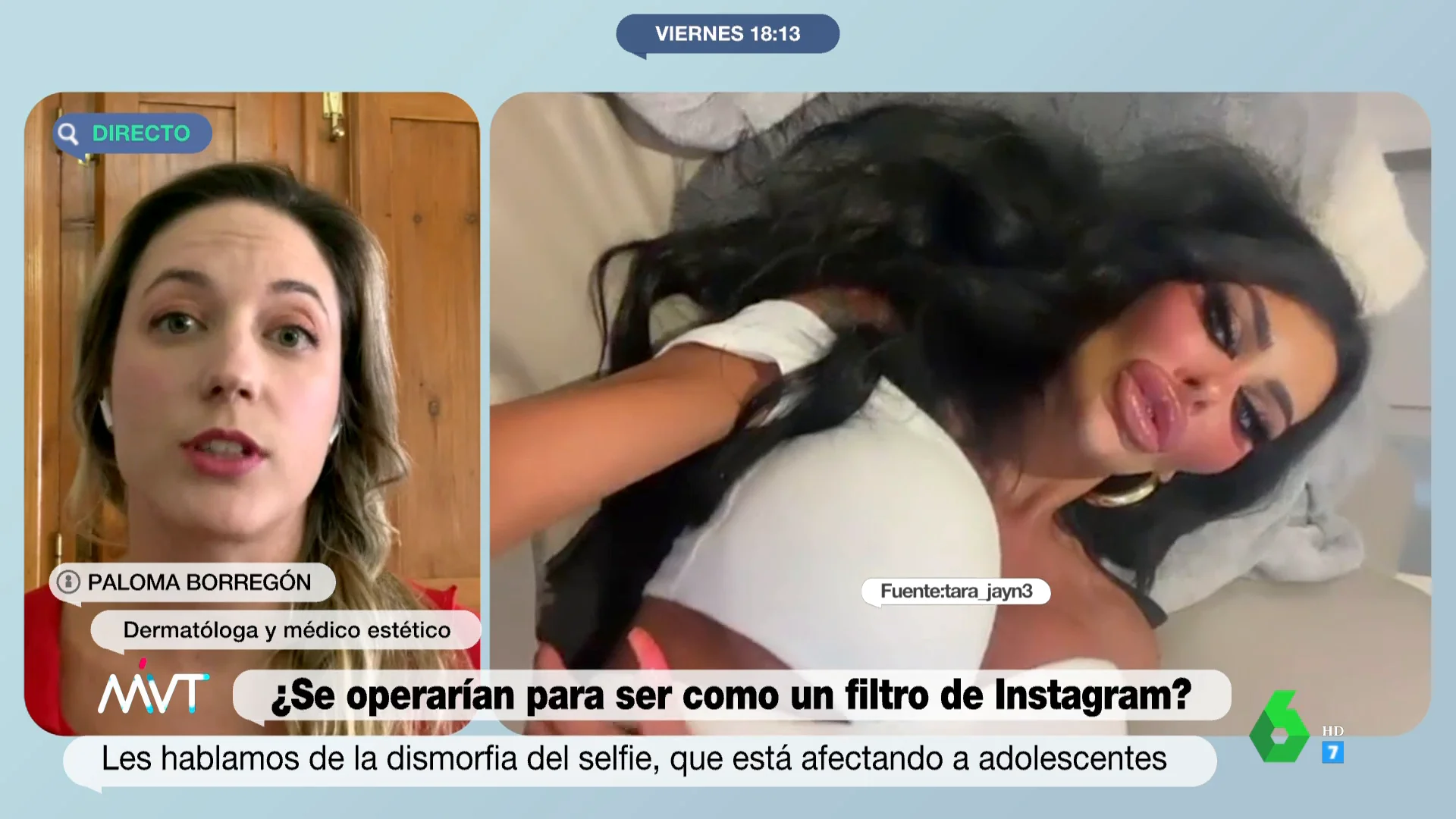 Afectados por la dismorfia del selfie