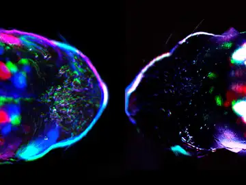 Cabezas de ratón al microscopio Cabezas de ratón al microscopio